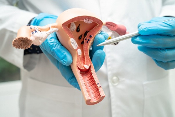 Urinary Tract Infection (UTI): Causes, Symptoms, Treatment, Prevention & Sexual Health Tips